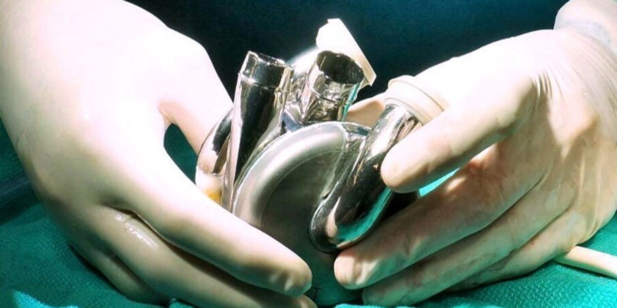 Man lives with artificial titanium heart for 105 days while awaiting donor transplant