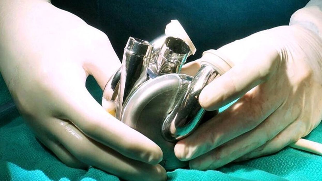 A photo of a surgeon handling the BiVACOR Total Artificial Heart