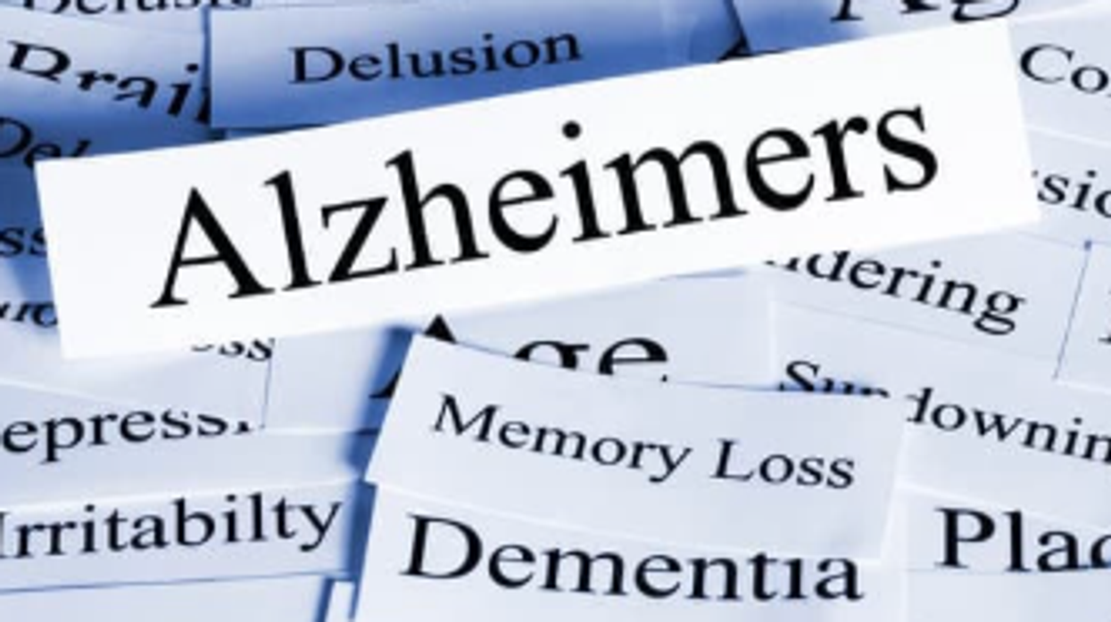 Alzheimer's, Alzheimer's Disease, research, memory loss