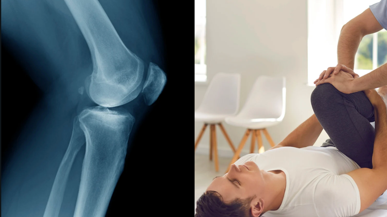 arthritis, medical treatment, gait retraining, medication, medicine