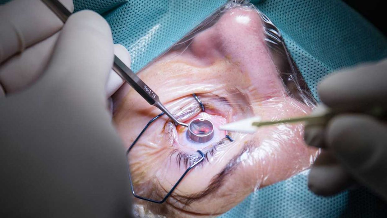 bionic eye, eye implant, deepfakes, electronic implant, AI generated, brain computers, Elon Musk, blind