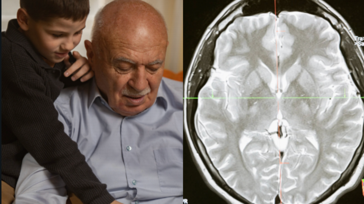 brain age, neuroscience, dementia, cognitive, scientific discovery