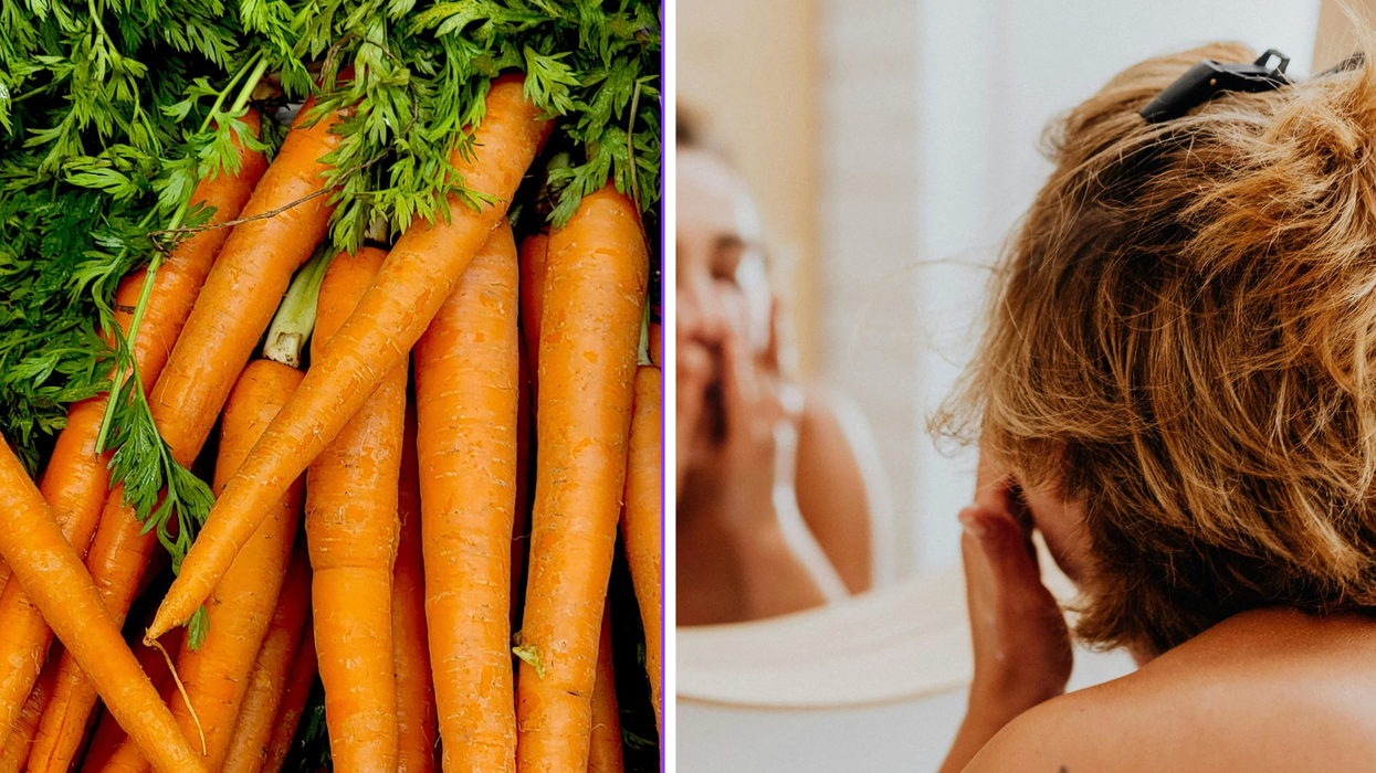 carrots, carotenosis, skin turning orange, Reddit, viral story, u/AhsewkaTano, health, nutrition, side effect, healthy eating