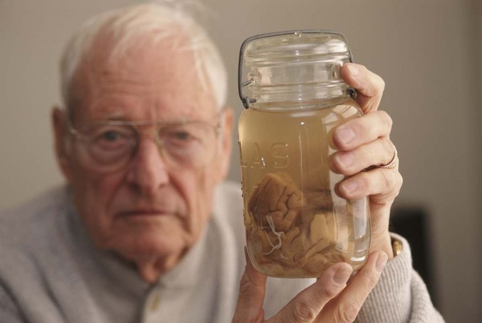 Image Source: Pathologist Thomas Harvey (1912 - 2007) holds the brain of theoretical physicist Albert Einstein in a jar, Kansas, 1994. Harvey performed the autopsy on Einstein in 1955, and retained parts of the brain for scientific study. (Photo by Michael Brennan/Getty Images)