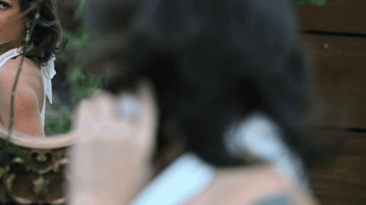 kate bogner, scleroderma en coup de sabre, facial scars, skin positivity, self advocacy, national scleroderma foundation, body confidence, holistic health coach, overcoming bullying, autoimmune disease awareness