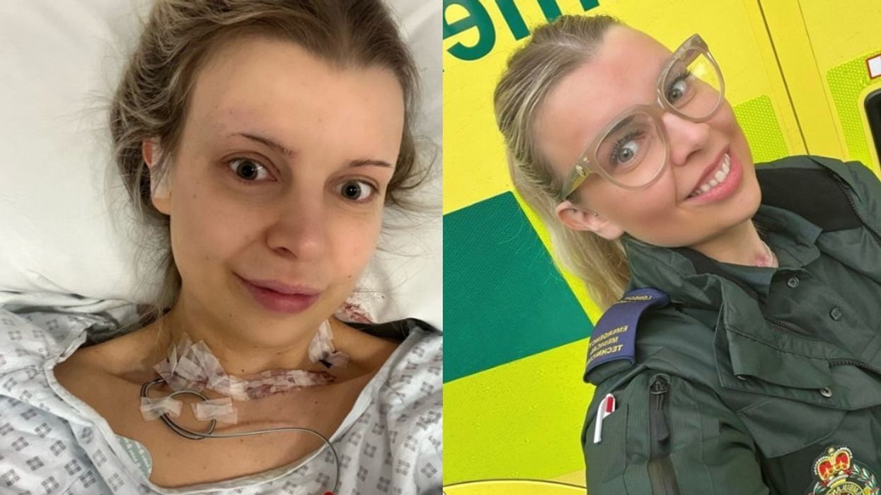 Katherine Murrell during and after her cancer treatment.