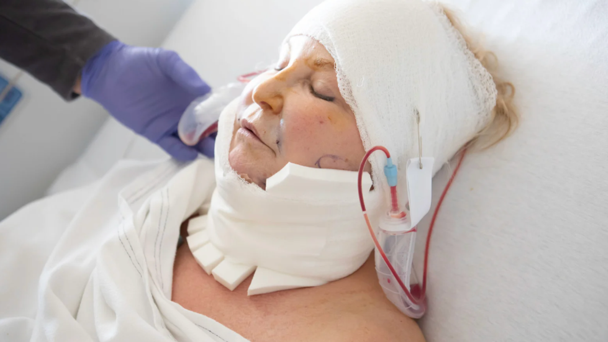 medical miracle, inspiration, decapitation, ehlers-dahlos syndrome, hope