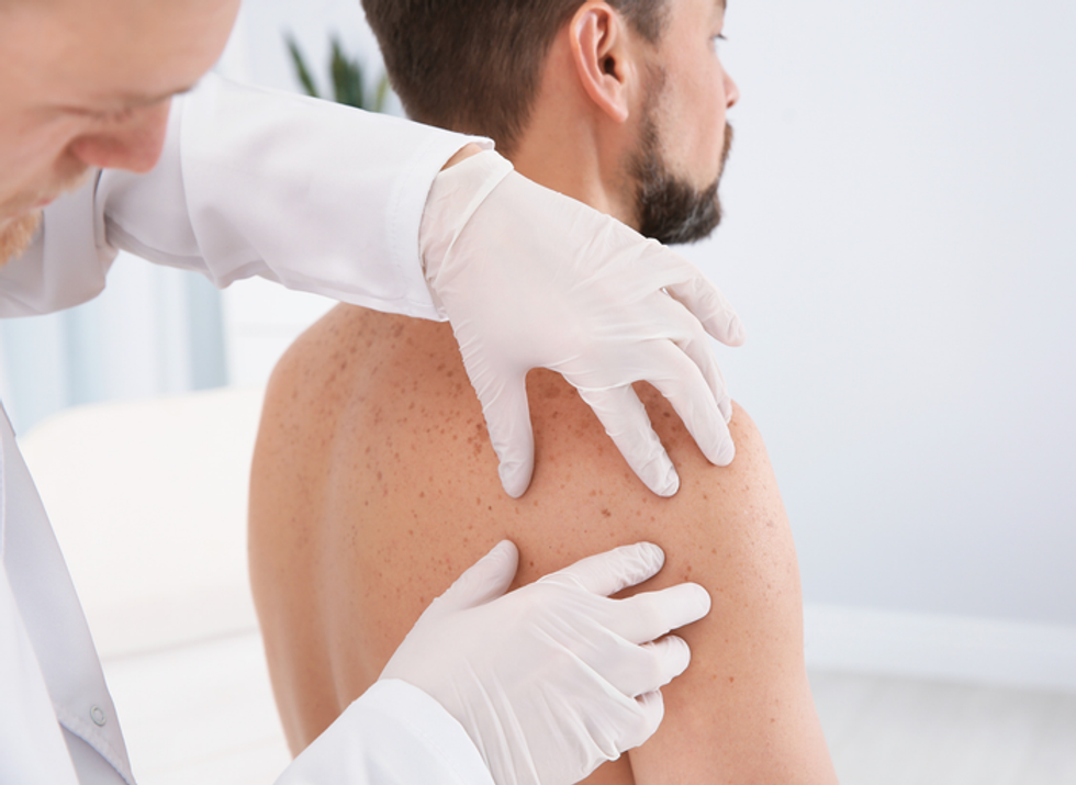 mole mapping, early detection, partner health, TikTok health, viral story, skin cancer signs, biopsy results, preventive care, Utah couple, dermatology tips, patient advocacy, health checklist, mole screening, cancer screening, body mapping, healthcare stories, TikTok dermatology