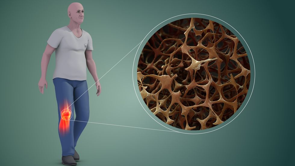 skeletal health, aging, injury, genetics, osteoblasts, osteoclasts, bone-resorbing cells, stimulate bone growth