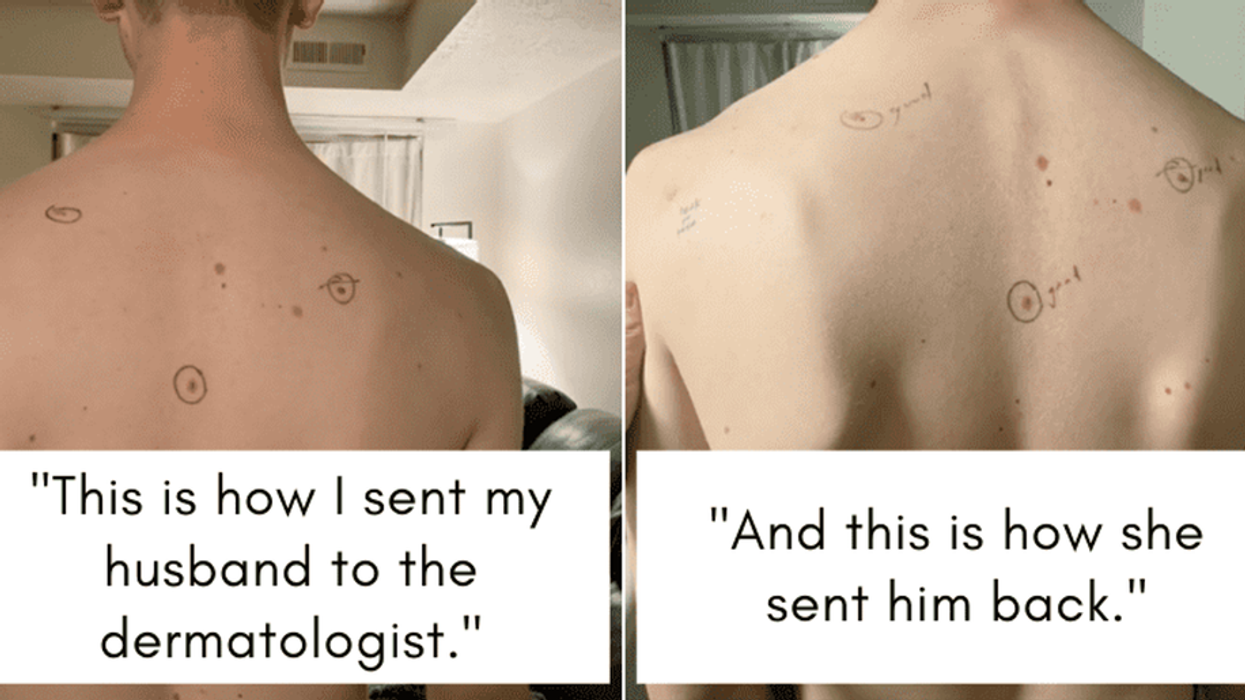 skin cancer, health, preventative care, melanoma, dermatology, TikTok, viral story, life hack, marriage, relationships, intuition, good news