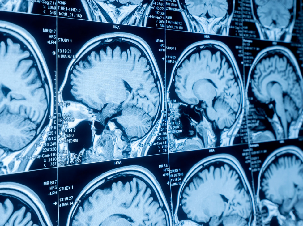 sonogram, ultrasound, dog, baby, In\u00eas Egner, Goulash, TikTok, viral video, pregnancy, funny