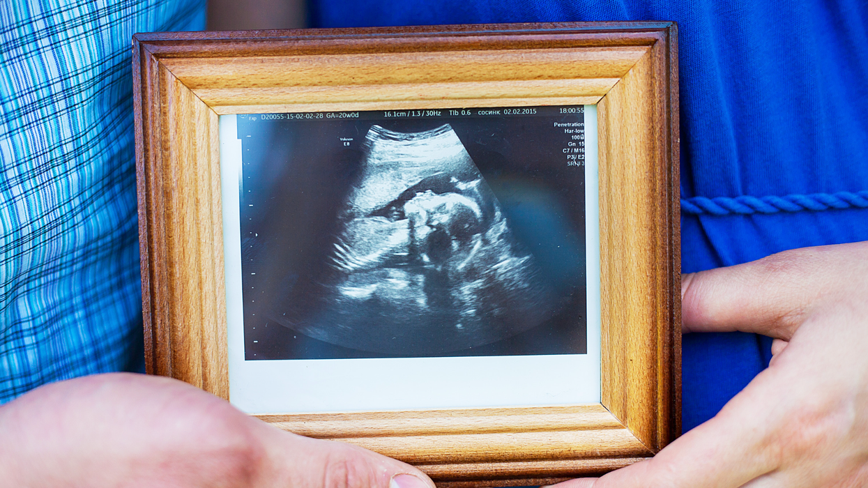 sonogram, ultrasound, dog, baby, Inês Egner, Goulash, TikTok, viral video, pregnancy, funny