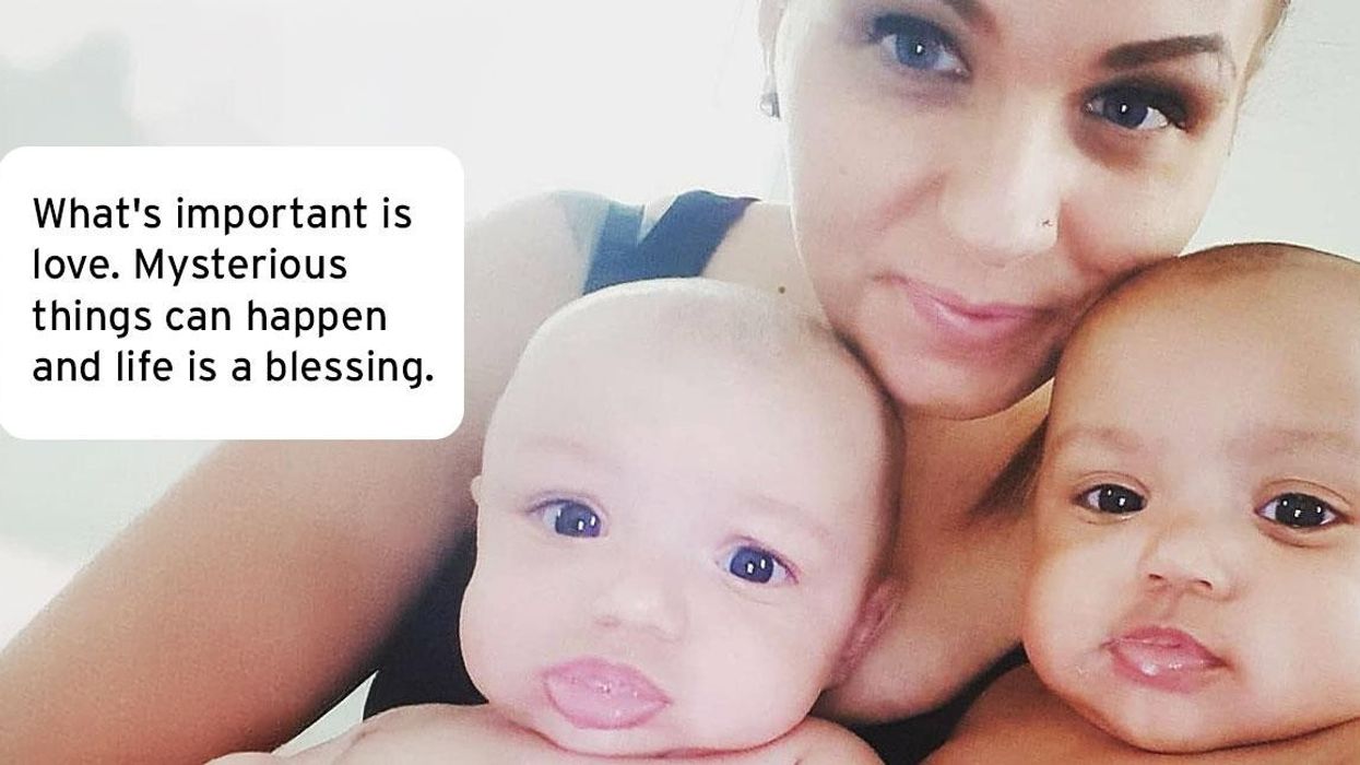 twins, biracial twins, mixed race, viral twins, miracle babies, family love, genetic surprise, parenting, diversity, racial identity, internet famous, heartwarming story