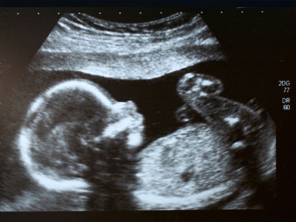 ultrasound, human baby, burrow, uterine tissue, invasive process, bioengineering, fertility clinic