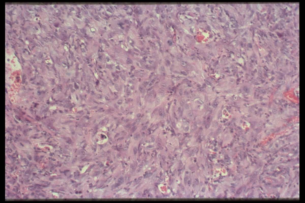 Representative Image Source:  Photos of cancerous cells. (Photo by Brooks Kraft LLC/Sygma via Getty Images)