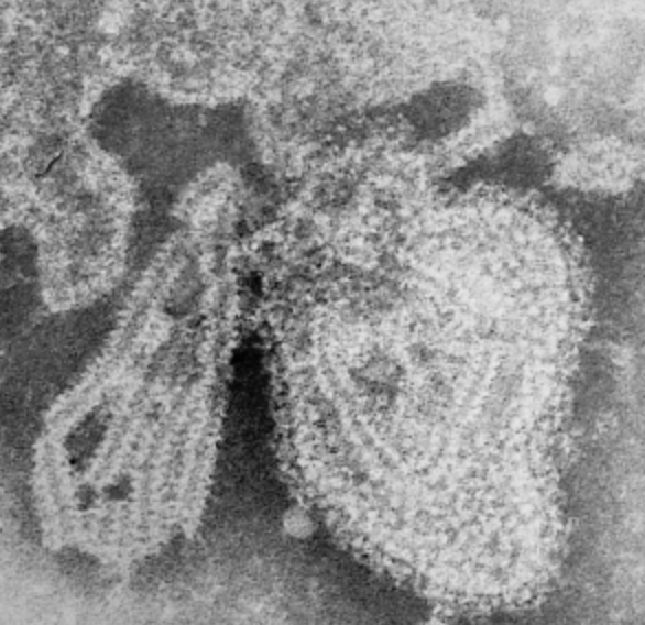 Mumps virus
