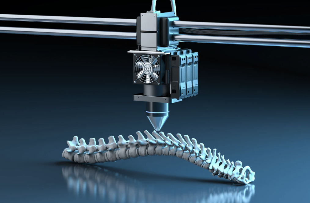 3D printing of a plastic spine