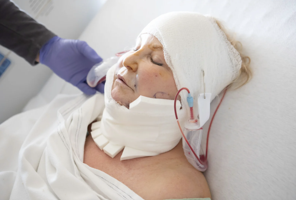 medical miracle, inspiration, decapitation, ehlers-dahlos syndrome, hope