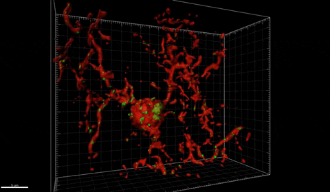 cancer, tumors, structures, cancer cells, tumor structures, technology, eradicate, researchers