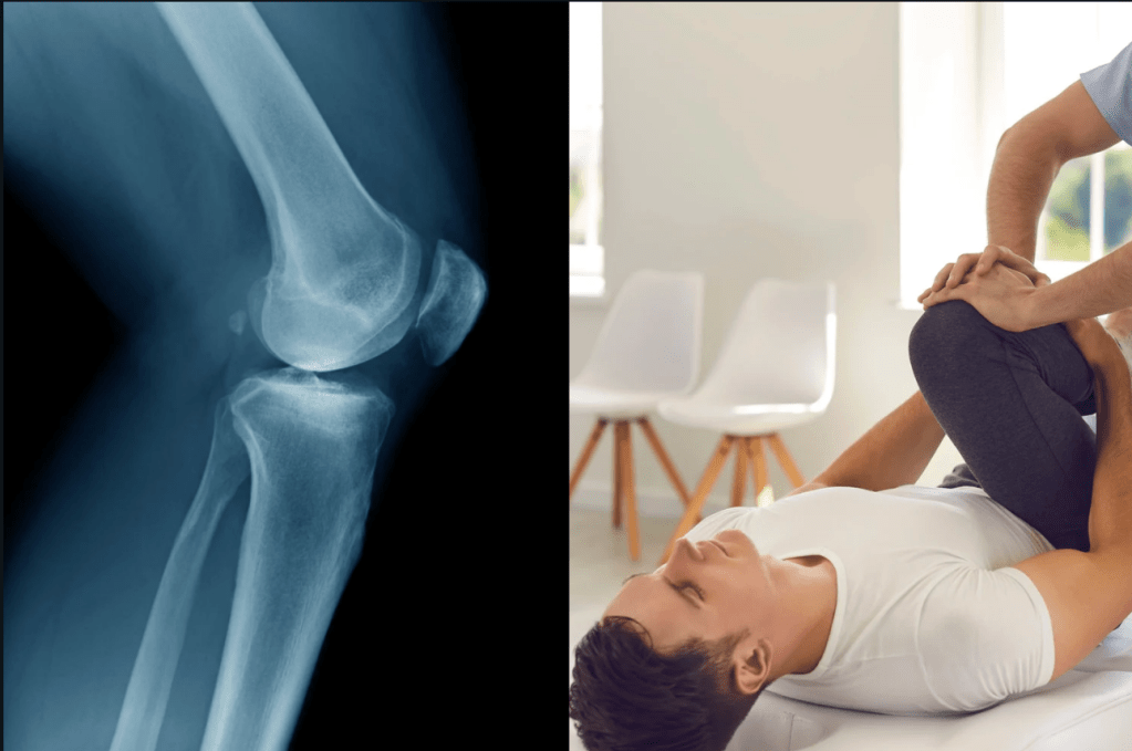 arthritis, medical treatment, gait retraining, medication, medicine