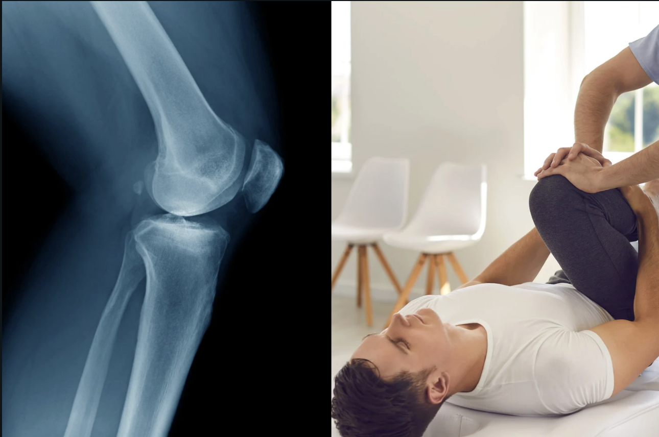 arthritis, medical treatment, gait retraining, medication, medicine
