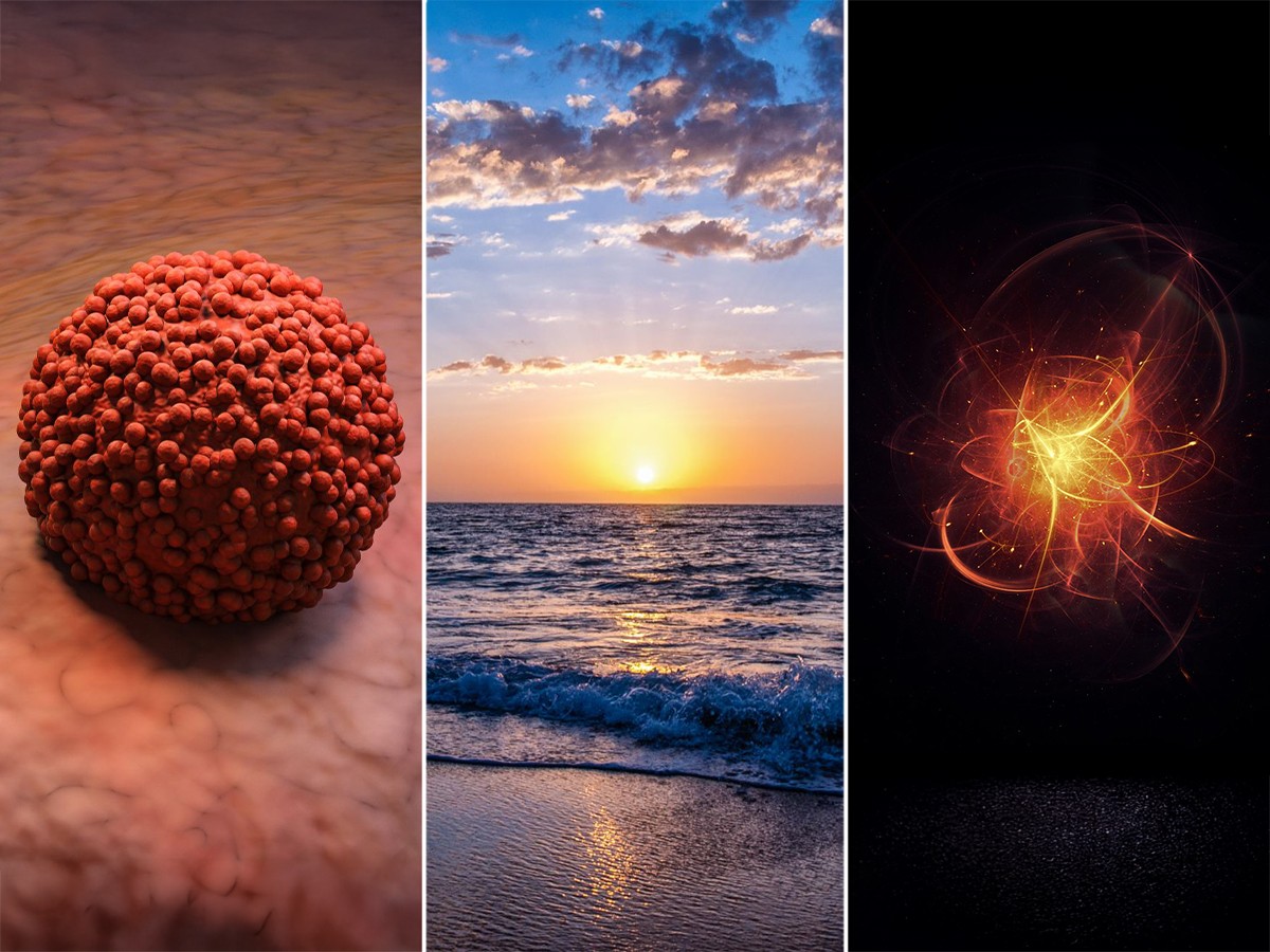 Array