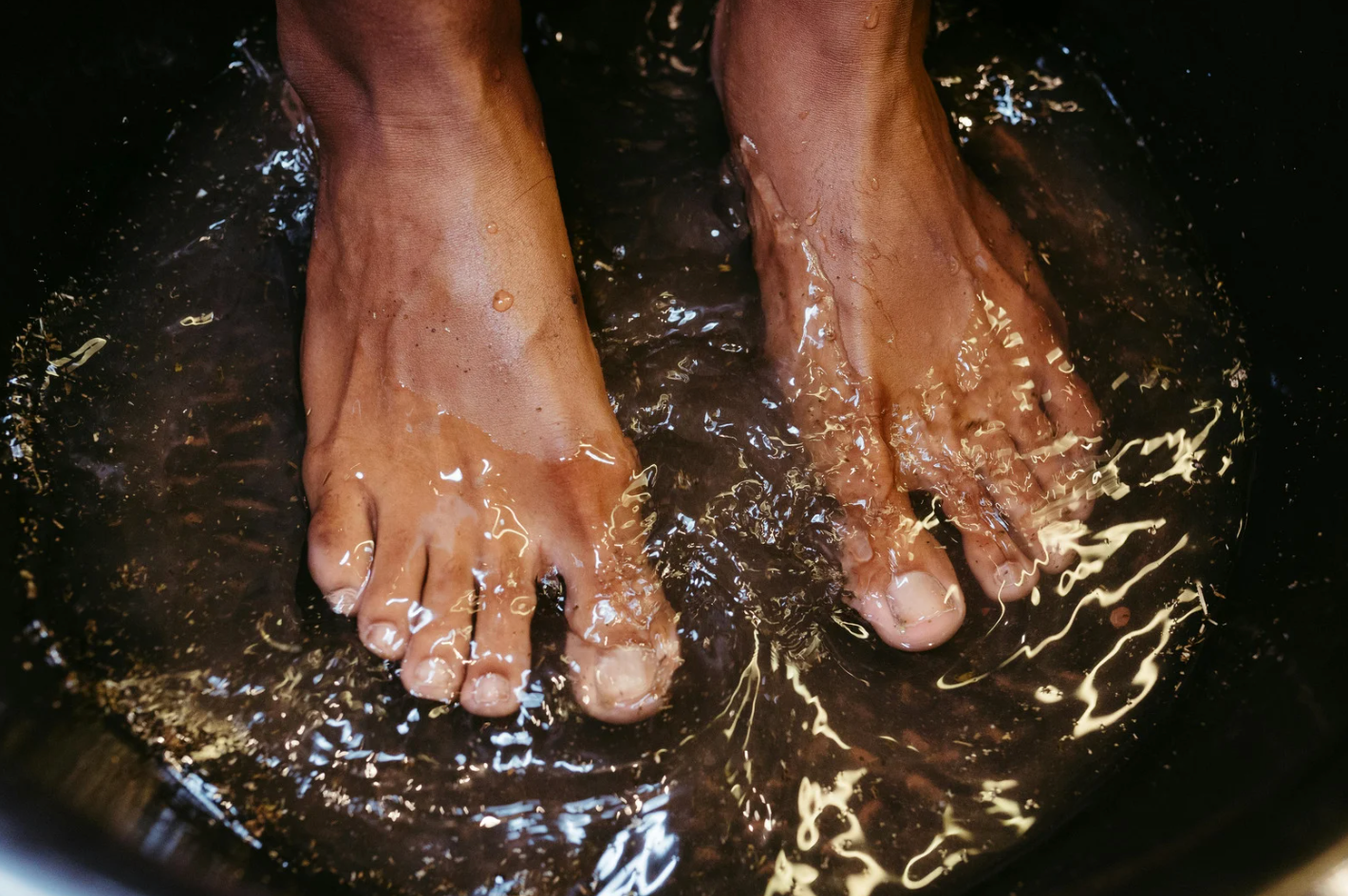 migraine, headache, migraine relief, health hack, TikTok, natural remedy, pain relief, chronic pain, wellness, hot water therapy