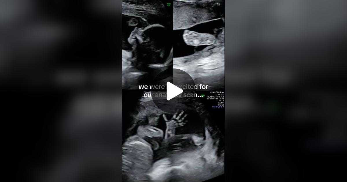 sonogram, ultrasound, dog, baby, Inu00eas Egner, Goulash, TikTok, viral video, pregnancy, funny