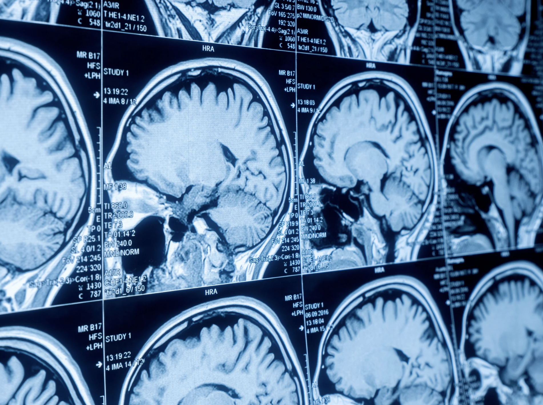 sonogram, ultrasound, dog, baby, Inu00eas Egner, Goulash, TikTok, viral video, pregnancy, funny