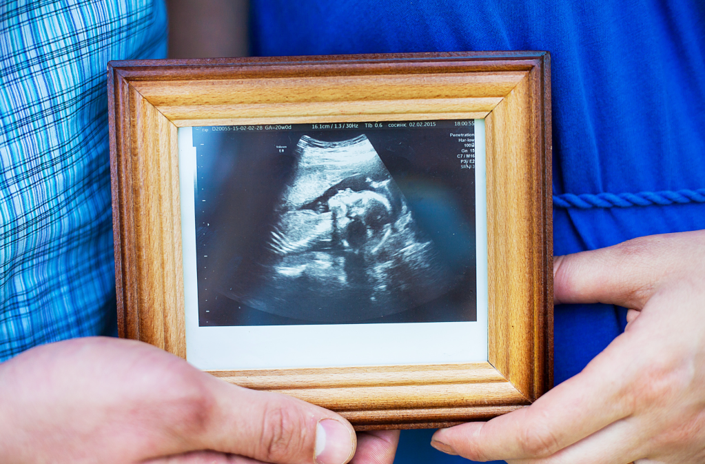 sonogram, ultrasound, dog, baby, Inês Egner, Goulash, TikTok, viral video, pregnancy, funny