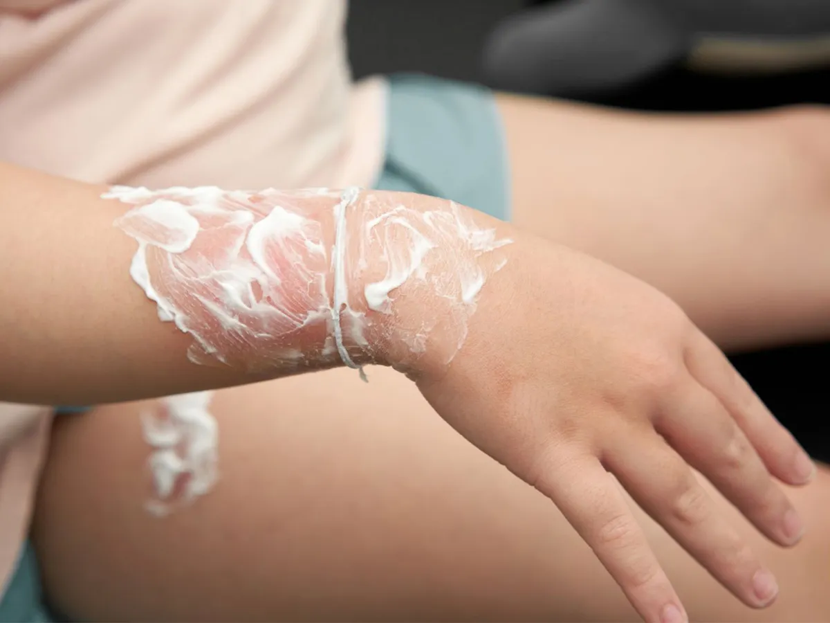 hydrogel, wounds, medicine, battery, injuries, medical breakthrough, tissue, skin