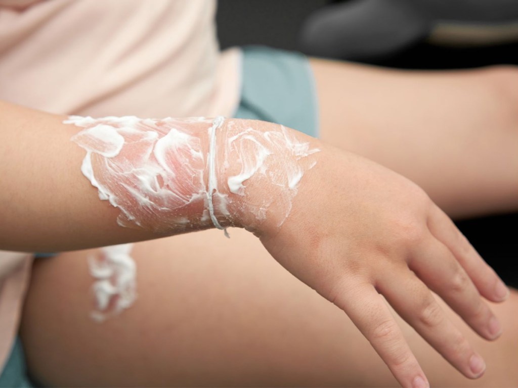 hydrogel, wounds, medicine, battery, injuries, medical breakthrough, tissue, skin