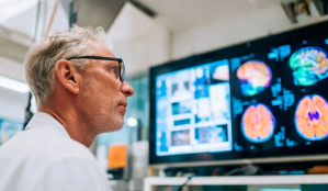 memory loss reversal, FTL1 protein, brain health, cognitive decline, UCSF research, aging breakthroughs, MIND diet, neuroscience, alzheimers prevention, neuroplasticity