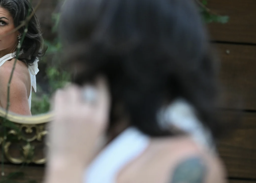 kate bogner, scleroderma en coup de sabre, facial scars, skin positivity, self advocacy, national scleroderma foundation, body confidence, holistic health coach, overcoming bullying, autoimmune disease awareness