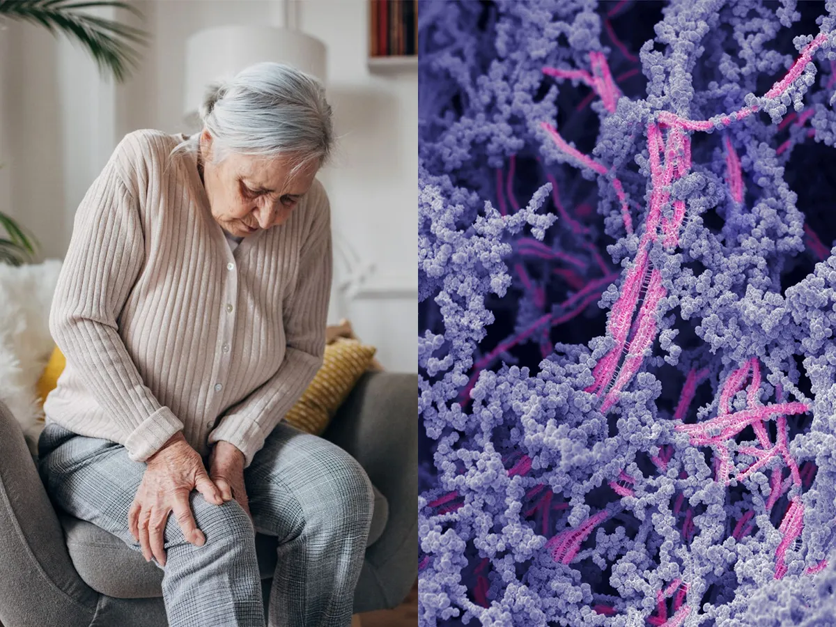 good.is - Mark Wales - Goodbye, knee pain. In a medical first, scientists have found a way to regrow damaged cartilage.