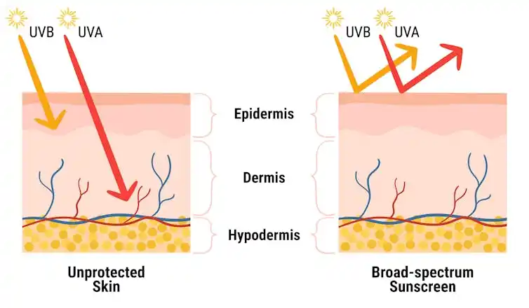 A graphic depiction of UVA and UVB rays penetrating the skin and their deflection with sunscreen.